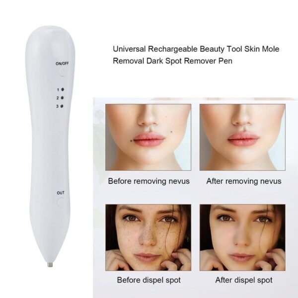 Spot Removal Pen Face Skin Dark Spot Remover - Image 2
