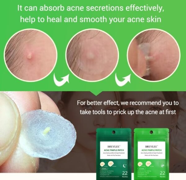 Tea Tree Acne Patch Fades Acne Marks and Ultra-thin - Image 8