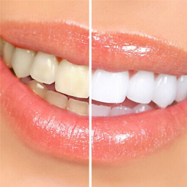 Beauty Tooth Brush Clean Tooth Brush Beauty Tooth Gel - Image 3