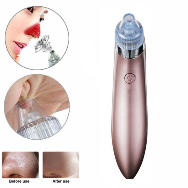 Electric Blackhead Vacuum Pore Cleaner Acne Pimple Remover Strong Suction Tool Electric Blackhead Remover Pore Vacuum Suction Diamond Dermabrasion Face Cleaner - Image 6