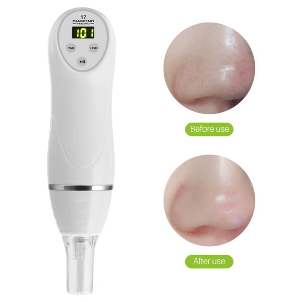 Electric pore suction and acne removing device beauty cleaner - Image 4