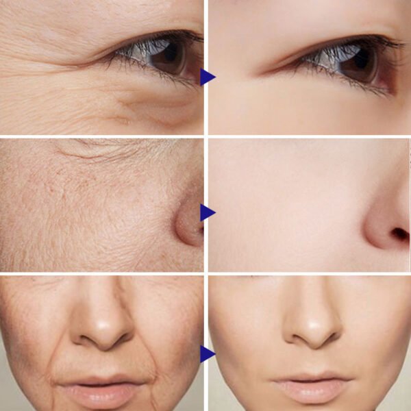 Vitamin C Serum Facial Serum Amazon - Image 3