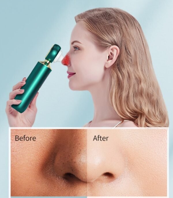 Portable Visual Blackhead Meter Household USB Electric Magnifying Glass Suction Pore Cleaner Blue Light Cleansing To Blackheads - Image 5