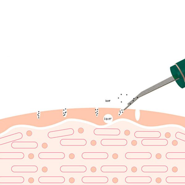 Ultrasonic Skin Rejuvenation Whitening Shoveling Machine Exfoliating Skin Care - Image 3