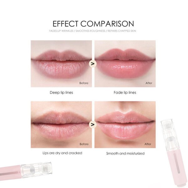 Lip Care Roller Household Mini Introducer - Image 4